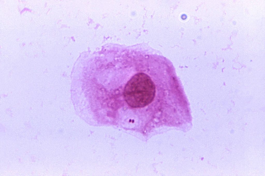 Neisseria meningitidis bacteria, responsible for causing meningococcal meningitis. Courtesy: CDC