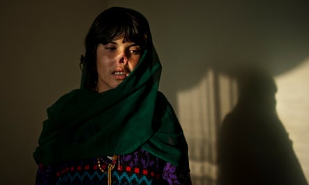 Bibi Aisha, an Afghan woman, was disfigured by her husband after she fled their abusive marriage.