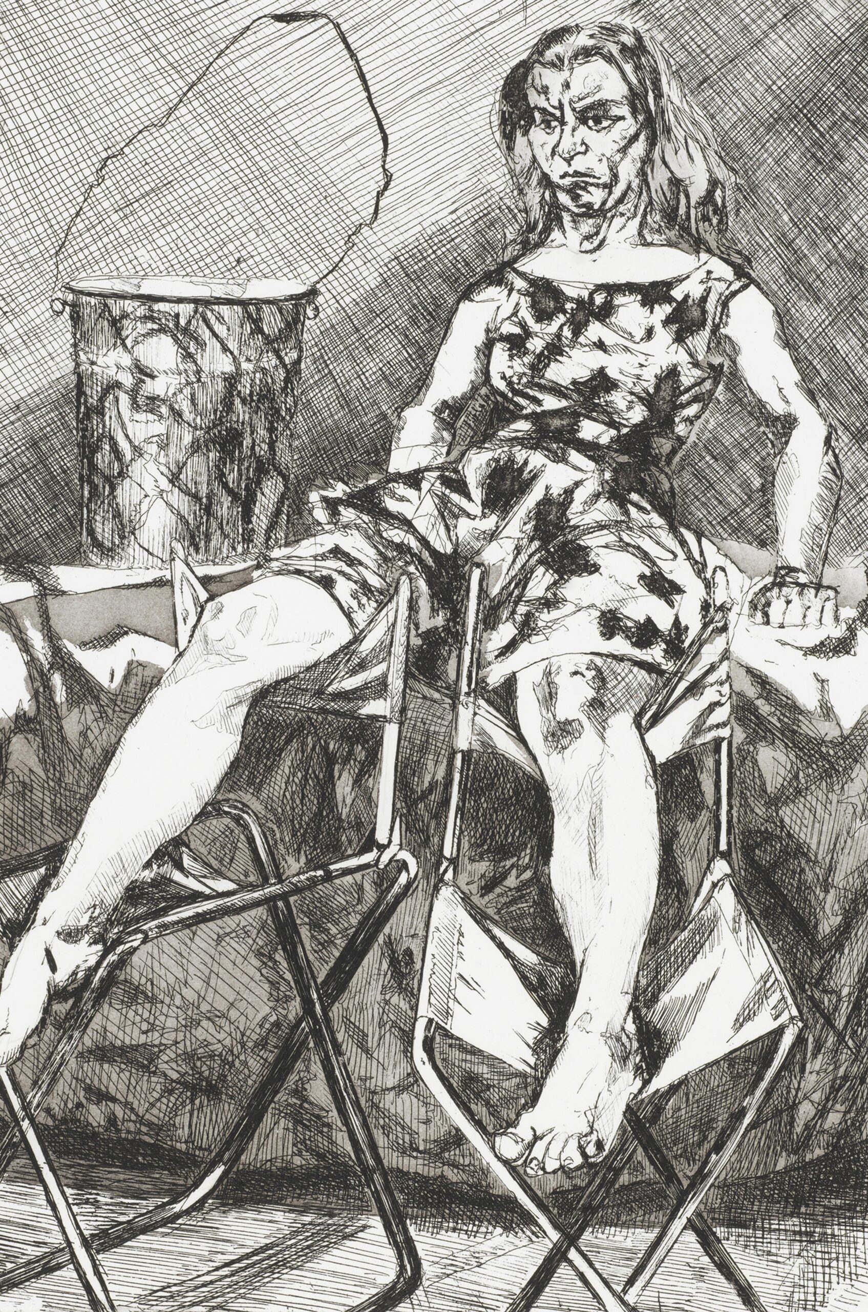 Woman sitting appearing bruised.
