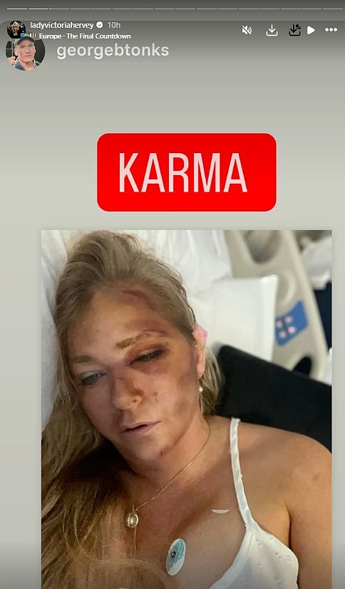 Prince Andrew's former girlfriend, socialite Victoria Hervey, called Giuffre a 'fantasist', suggesting she was lying over the extent of the crash through a repost of her selfie in a hospital bed with the word 'Karma' added to it