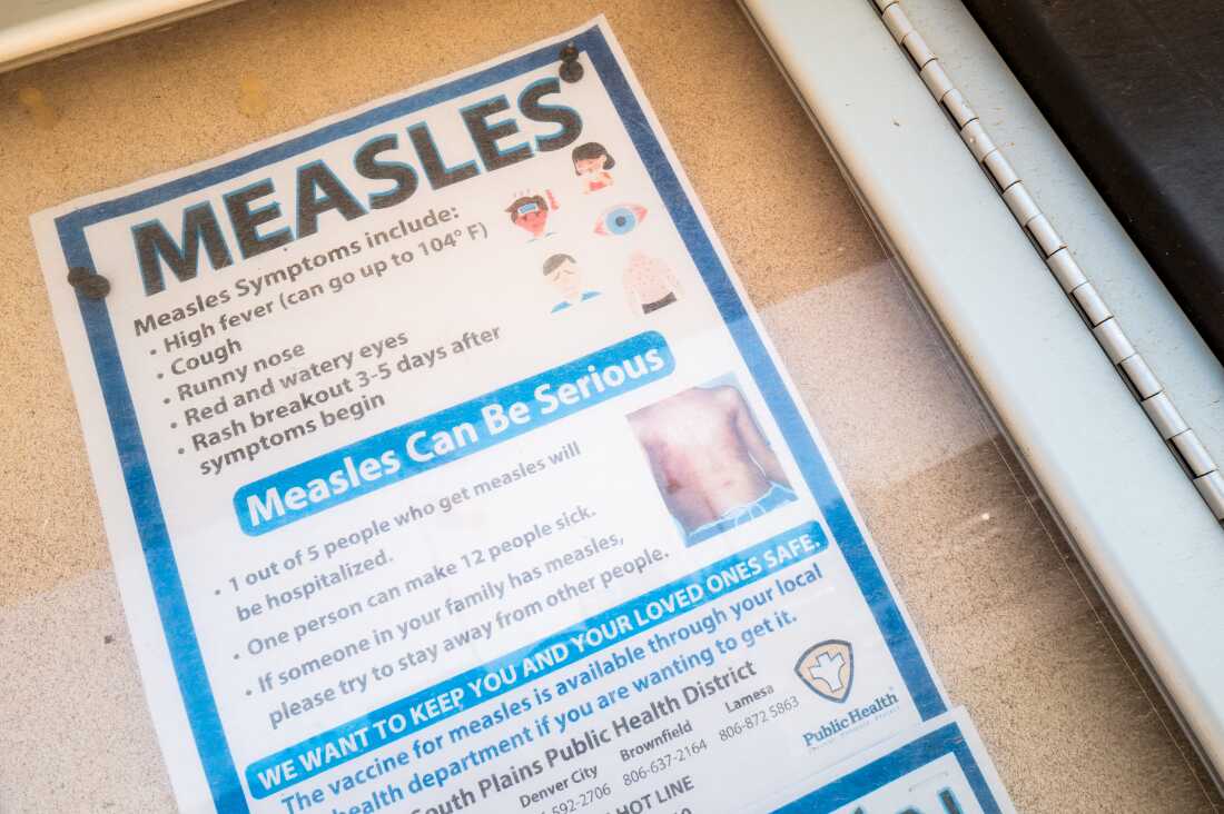 A measles advisory is shown tacked to a bulletin board outside Gaines County Courthouse in Seminole, Texas, on April 9. The Texas Department of State Health Services has confirmed hundreds of measles cases.